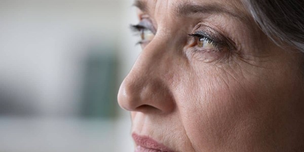 rhinoplasty for old patients naderi 02